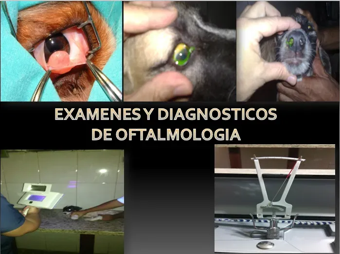 Oftalmología